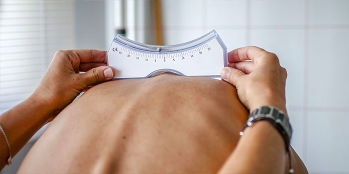 scoliosis treatment and chiropractic conditions in Austin